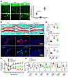 In vivo silencing of murine Dcc mRNA by siRNA systemic administration reduc