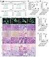 PtenK27-polyUb is required for renal fibrosis.