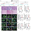 Triptolide reduces FA-induced kidney fibrosis.