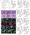 Inhibition of PtenK27-polyUb alleviates STZ-induced diabetic nephropathy.