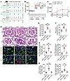 Pharmaceutical inhibition of PtenK27-polyUb alleviates diabetic nephropathy