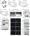 Triptolide inhibits PTENK27-polyUb and EMT.