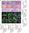 Triptolide alleviates kidney fibrosis.