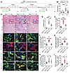 Inhibition of PtenK27-polyUb reduces FA-induced renal fibrosis.