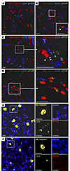 Immunological synapse formation between MCs and γδ T cells at infection sit