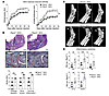 Ptpn2 haploinsufficiency aggravates mannan-induced arthritis in SKG mice.