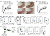 IL-6 promotes arthritis and Treg conversion in Ptpn2-haploinsufficient mice