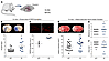 NOX5 leads to increased stroke size and BBB damage and aggravates neuromoto