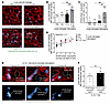 Accumulation of labeled rTEM neutrophils in lungs is linked with lung injur