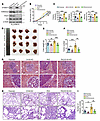 PCK1 deficiency induces HCC cell proliferation, migration, and tumorigenesi