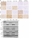 Reductive H3K9me3 modification at S100a11 promotes DEN/CCl4/PB-induced hepa