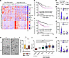 surgery for patients from TCGA-PRAD (B) and the <span class='search_term...