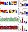 NOX2 inhibition prevents atrial fibrosis and increases atrial CV in DIO mic