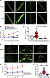 NOX2 inhibition in PA-treated hiPSC-aCMs using the NOX2 small-molecule inhi