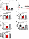 siRNA knockdown of PITX2 abrogates the effect of PA on hiPSC-aCMs.