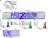 AT of Tregs mediates resolution of lung injury in Rag-1–/– mice.