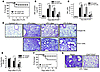 Manipulation of Tregs in WT mice determines resolution of lung injury.