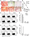 Lack of TLR9-MyD88 signaling diminishes CD8+ T cell responses to the AAV ca