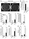 KLF4-deficient macrophages exhibit enhanced bactericidal activity.