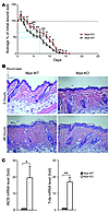 Myeloid KLF4 deficiency results in delayed wound healing.