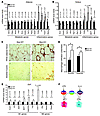 Mye-KO mice exhibit altered inflammatory and metabolic gene expression in t