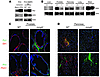 MMP9 levels control PN1 expression and indirectly regulate SHH levels.