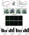 PN1 inhibits tumor growth and influences angiogenesis in vivo.