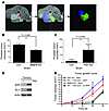 Effect of MMP9 and PN1 on orthotopic prostate tumor growth.