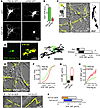 PSD-95 knockdown or peptide disrupting PSD-95–D1R interaction alters D1R su