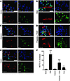 Activated platelets induce NET formation in human neutrophils.