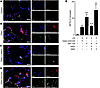 NETs are present in TRALI mouse lungs, and aspirin decreases NET formation.