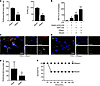 DNase1 treatment decreases TRALI and NETs.