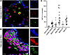 NETs are present in human TRALI lungs and plasma.