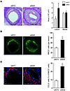 Role of BCL6 in miR-155–mediated atherosclerosis.