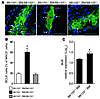 Expression of lesional BCL6 is miR-155 dependent.