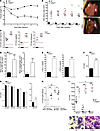 Impaired response of Cebpe–/– mice to S. aureus infection.