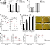 NAM augments killing of S. aureus by a C/EBPε-dependent mechanism.