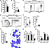 Undifferentiated AML cells are resistant to loss of mTORC1 activity.