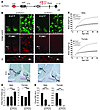 ArcPomc–/– mice are obese and hyperphagic due to an impairment in hypothala