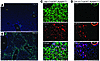 Hepatocytes on the periphery of central veins in the hepatic lobules are co