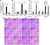 Suppression of DC-NKT interaction in vivo by A2AR activation or by treatmen