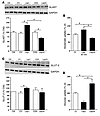 Leptin-induced modifications in glutamate and glucose uptake by hypothalami