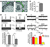 Effects of maternal diet on glial coverage and glucose sensitivity of POMC