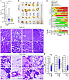 NAD+ precursor treatment inhibits spontaneous breast cancer progression in