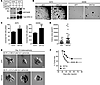 WNT5A overexpression enhances melanoma cell proliferation.