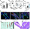 IL-33 induces cholangiocyte proliferation.