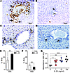 IL-33 induces proliferation of cholangiocytes from hilar bile ducts and a c