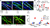 IL-13 as a molecular effector of IL-33–induced proliferation.