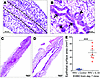 IL-33 promotes epithelial repair in experimental biliary atresia.