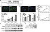 NAFLD hepatocytes preferentially undergo an altered cell cycle.